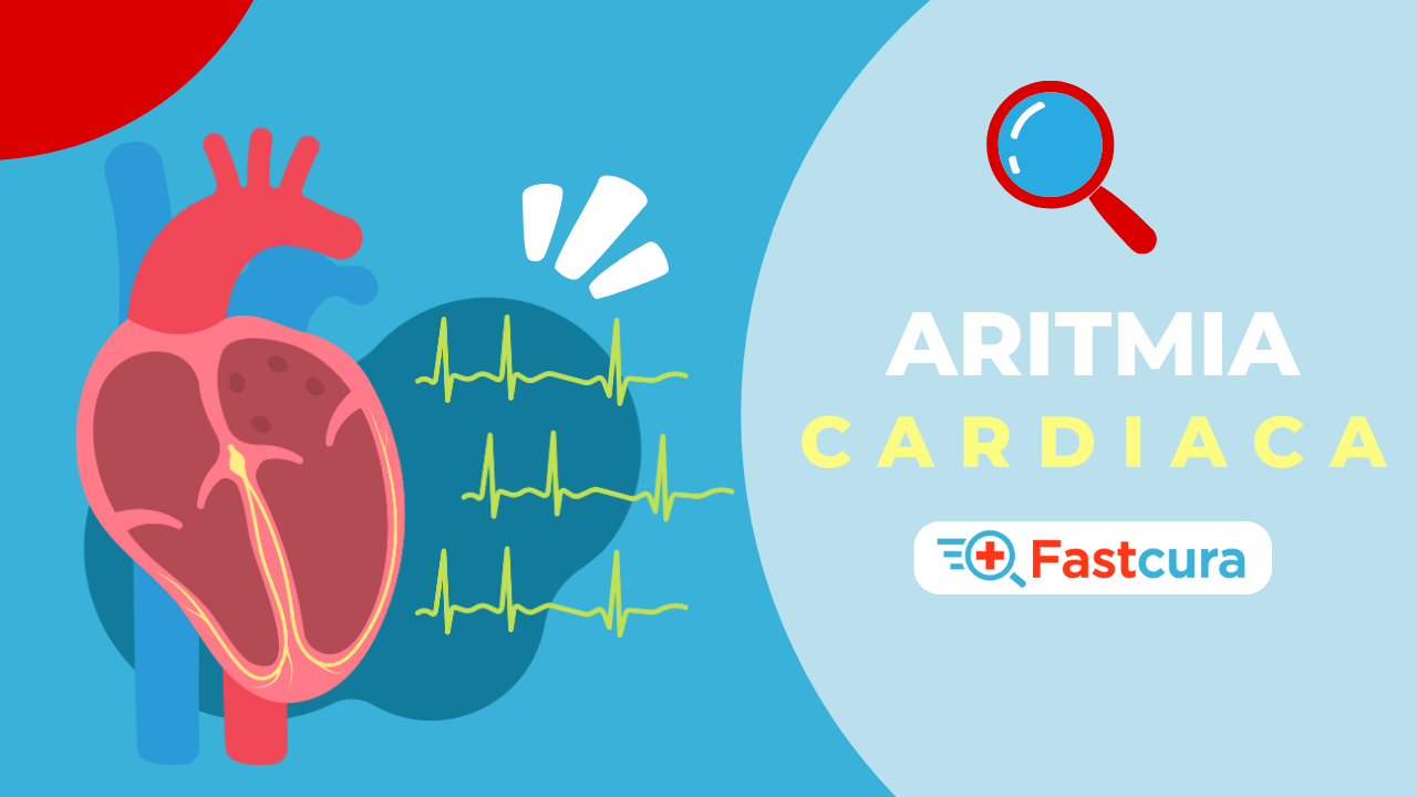 Aritmia Cardiaca